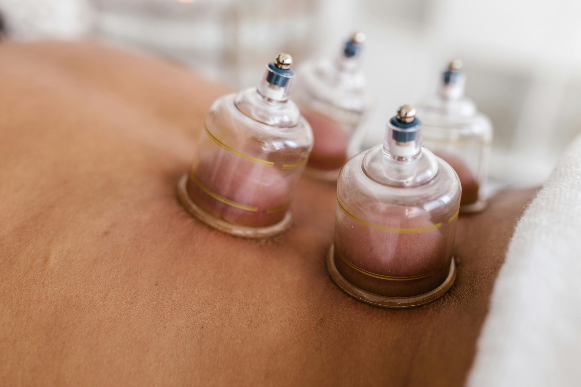 Cupping therapy on skin

